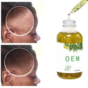 Aceite Natural orgánico para el cabello y el cuero cabelludo con logotipo personalizado, aceite Ayurveda para tratamiento profundo, aceite para crecimiento del cabello de bebé para niños