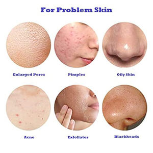 Ampoules de sérum N.CTF HA <span class=keywords><strong>134</strong></span> pour l'élimination des marques d'acné, booster cutané, améliore la qualité et la texture de la peau - Product Image 2