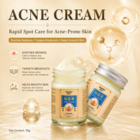 Crème pour le visage contre l'acné, élimine les marques d'acné, resserre les pores, adoucit et lisse la peau, améliore la peau acnéique, crème de soin du visage, crème de soin de la peau