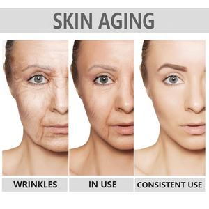 Serum Perawatan Kulit Wajah Anti Penuaan Pemutih Kulit dengan Formula Sempurna Kojic Acid Collagen - Product Image 6