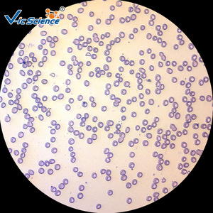 Factory direct supply of biological slides for medical histology, regeneration, <strong>aplastic</strong> anemia, and bone marrow smears. - Product Image 1