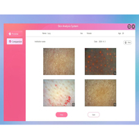 Analyseur automatique de peau intelligente AI Instruments de diagnostic de la peau du visage