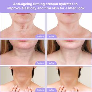 Crema Reafirmante y Lifting Instantáneo para el Cuello de Marca Privada ELAIMEI, Crema Blanqueadora <span class=keywords><strong>Japonesa</strong></span> para Aclarar el Cuello Oscuro al por Mayor - Product Image 3