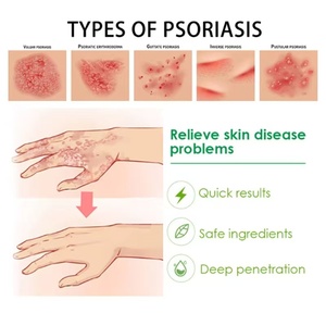 Pommade Apaisante à Base de Plantes 20g Améliore le Psoriasis <span class=keywords><strong>et</strong></span> les Affections Cutanées Associées - Product Image 5