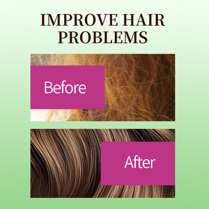 Mascarilla Capilar Greenlem de Romero y Menta - Product Image 3