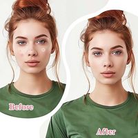 Patch anti-acné à l'huile d'arbre à thé – Meilleur traitement des imperfections – Patch pour le soin du visage – Facile à retirer