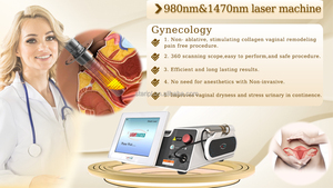 Dispositivos Ginecológicos Portátiles Avanzados para el Tensado Vaginal con Láser de 980nm y 1470nm, Terapia de <span class=keywords><strong>Luz</strong></span> Roja y LED - Product Image 4