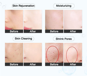 Mesin wajah terbaru mesin Penyejuk wajah <span class=keywords><strong>Cryo</strong></span> elektrik wajah mesin Mesotherapy M mesin elektroterapi - Product Image 6