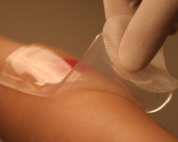 OEM Medical Hydrogel Sheet Wound Dressing Hydrogel Patch for Burn Care and Wound Management Manufacturer