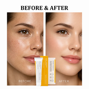 Crema Facial Aclarante con Nicotinamida OEM, Marca Surcoreana para el Cuidado de la Piel, Hidrata y Elimina Manchas - Product Image 4