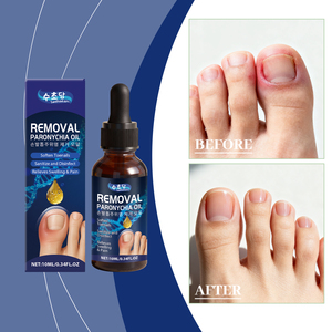 Etiqueta privada, gotas aceptables para el cuidado <span class=keywords><strong>de</strong></span> <span class=keywords><strong>las</strong></span> <span class=keywords><strong>uñas</strong></span>, fórmula suave, reparación <span class=keywords><strong>de</strong></span> <span class=keywords><strong>uñas</strong></span>, mejora la paroniquia, pie, mano, <span class=keywords><strong>hongos</strong></span> en <span class=keywords><strong>las</strong></span> <span class=keywords><strong>uñas</strong></span>, suero para eliminar el cuidado - Product Image 4