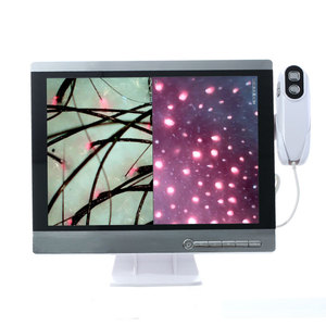 ماسح فروة الرأس اللاسلكي كاميرا HD الشعر بصيلات الشعر لالتقاط الصور وتحليل الفيديو - Product Image 2