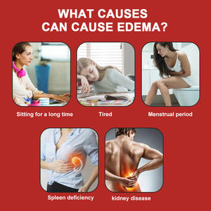 Crema per la cura della salute del corpo a base di erbe naturali da 20g per eliminare l'edema e il gonfiore della fornitura di assistenza sanitaria - Product Image 2