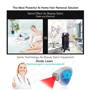 Cơ thể mặt điều trị <span class=keywords><strong>Mini</strong></span> 808 Diode Máy tẩy lông bằng <span class=keywords><strong>laser</strong></span> - Product Image 5
