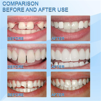 Nouvel Arrivage OEM : Gel pour Dents Prothétiques – Peut être Utilisé Temporairement pour Remplir ou Réparer les Dents Manquantes et Cassées – Dents Prothétiques Moulables