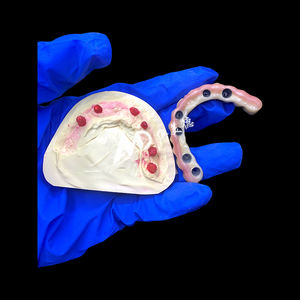 Premium Implantaat-Ondersteunde Prothese | Titanium <span class=keywords><strong>Abutment</strong></span> Met Precisie Zirkonia Kroon Voor Stabiele En Comfortabele Pasvorm - Product Image 1