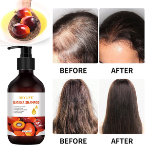 <span class=keywords><strong>Set</strong></span> per la Cura dei Capelli Biologico con Shampoo all'Olio di Rosmarino, Batana e Ricino Nero per la Crescita e la Riparazione Naturale dei Capelli, Prodotti da Bagno per <span class=keywords><strong>Uomo</strong></span> - Product Image 2