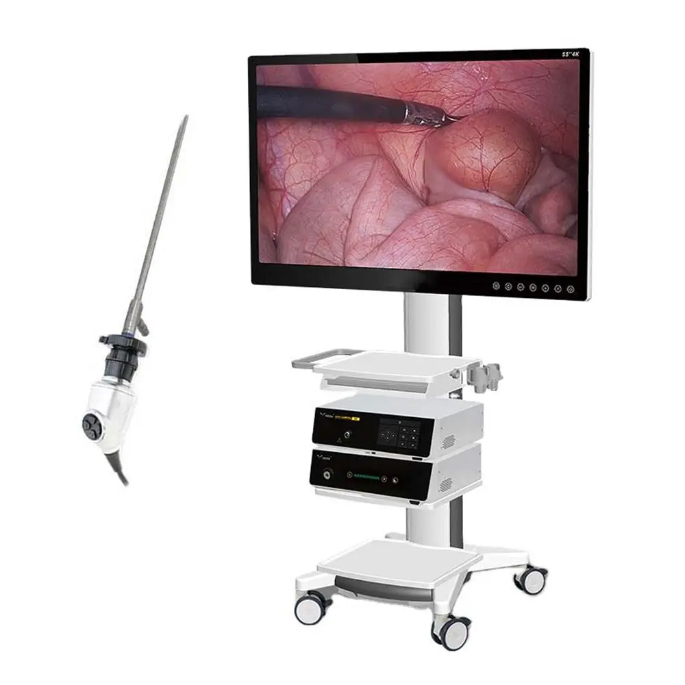 Dispositivos médicos gerais Instrumentos de cirurgia médica Instrumentos cirúrgicos abdominais Laparoscopia