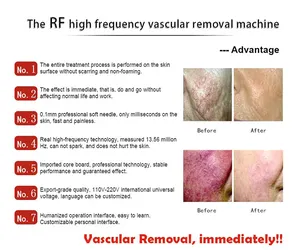 2024 Professionelle Vaskulartherapie Maschine zur Venentfernung Klinischer Gebrauch 45 w 980 nm Spinnennartbehandlung Vaskularentfernungswerkzeug