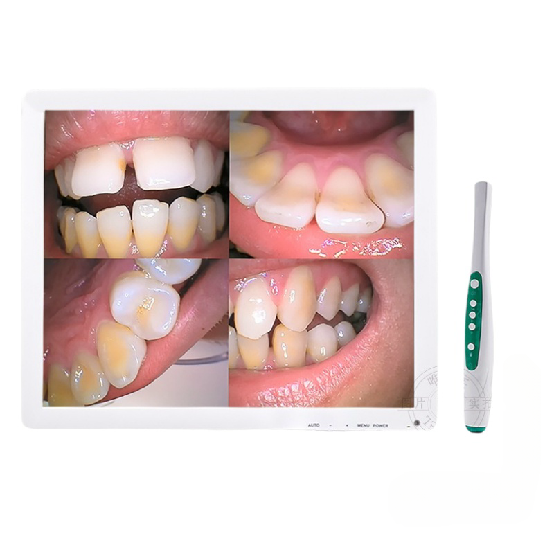 Dental Endoscope 17inch LCD Monitor VGA