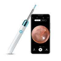 Curette auriculaire visuelle sans fil intelligente, endoscope haute définition, outil professionnel pour l'inspection des oreilles