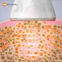 Máquina Profesional de Contorno Corporal con Rodillo de Vacío para Reafirmar la Piel y Reducir la Grasa para Salón de Belleza