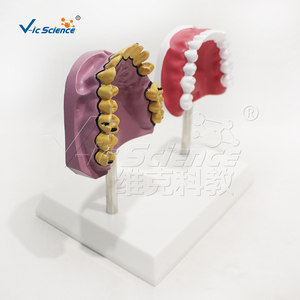 Maniquí <span class=keywords><strong>de</strong></span> PVC Ecológico para Demostración <span class=keywords><strong>de</strong></span> Dientes Saludables con Manchas <span class=keywords><strong>de</strong></span> Tabaco, para Estomatología, Higiene Bucal, Enseñanza en Laboratorio, E/ISO/ROHS/CNAS - Product Image 4