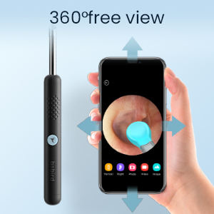 กล้องส่องตรวจหู,อุปกรณ์กำจัดขี้หูอัจฉริยะกล้องตรวจสอบ Otoscop Wifi ผลิตในจีน - Product Image 2