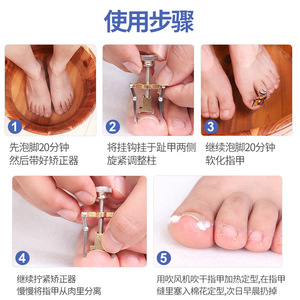 Nail groove corrector, pedicure tool, nail straightener, ingrown toenail clipper, nail clipper for correcting ingrown toenails - Product Image 4