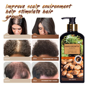 Productos para la Caída del Cabello al por Mayor, Champú para el Cabello con Aceite de Ricino - Product Image 5