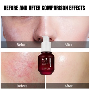 <span class=keywords><strong>Acide</strong></span> <span class=keywords><strong>salicylique</strong></span> AHA BHA de haute qualité pour 30ML exfoliant liquide doux pour le visage blanchir la peau améliorer la texture favoriser l'absorption - Product Image 3