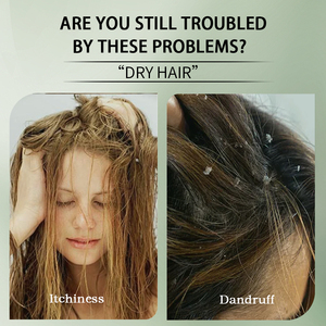 <span class=keywords><strong>2025</strong></span> thiết kế mới chăm sóc tóc gàu giảm nhẹ chăm sóc da đầu dầu gội cho tóc xoăn - Product Image 2