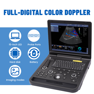 <span class=keywords><strong>Precio</strong></span> del Escáner de Ultrasonido Doppler Color para Aplicaciones en Ecografía Cardíaca, Abdominal y Vascular - Product Image 3