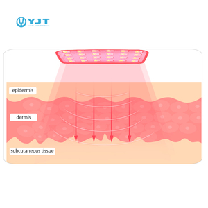 Produit thérapeutique médical de vente chaude Cou Led Instrument de traitement de la lumière rouge et bleue avec laser d'élimination de la rhinite - Product Image 2