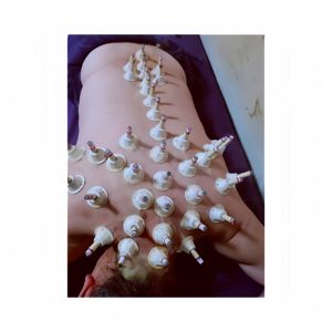 Efficiënte Moxibustionconditionering Expert Aangewezen Product Moxa Stick/Moxibustie Gips/Bijvoet Cakemoxa Kegels - Product Image 1