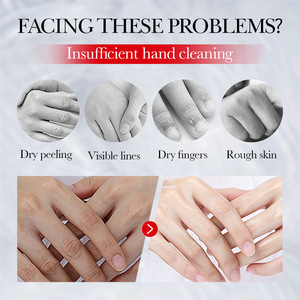 SADOER Crème Mains Hydratante Intense Nourrissante Réparatrice Éclaircissante Peaux Rugueuses à l'Acide Kojique pour Mains Sèches et Gercées - Product Image 5
