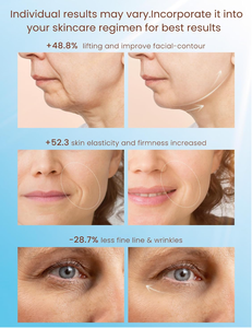 Tần số cao chăm sóc da mặt máy USB mắt thắt chặt loại bỏ nếp nhăn mặt nâng Massager cơ thể mụn trứng cá chăm sóc vẻ đẹp thiết bị - Product Image 4