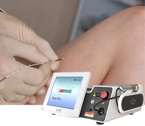 <strong>Medical</strong> Grade EVLT Diode 980nm/1470nm Varicose Spider Vein Vascular <strong>Laser</strong> Facial Endovenous <strong>EVLA</strong> Surgical Device Starlight - Product Image 1