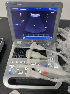 Ecografia Farb <span class=keywords><strong>doppler</strong></span> SUN-906B Tierarzt Ultraschall Tragbare Instrumente Tiere Ultraschall gerät - Product Image 5