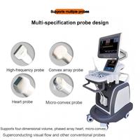 Machine à ultrasons Doppler couleur portable, ultrasons Doppler couleur cardiaque, instrument de diagnostic par ultrasons entièrement numérique