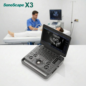 Échographe Doppler Couleur Portable Sonoscape X3 15,6'' Autonomie 90 min 3 sondes Abdomen Obstétrique Gynécologie Cardiologie CE - Product Image 1