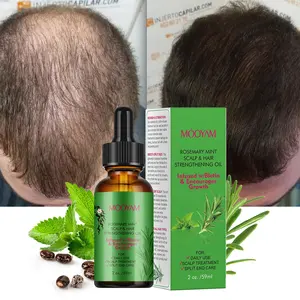 Private Label Biotin Rosemary Essential Oil Promote Hair Growth Strengthen Scalp Repair Care Mint Rosemary Hair Growth Oil