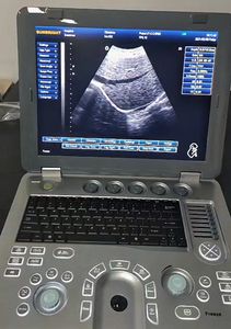 Promoción de Ultrasonido Veterinario Portátil, Especializado en Animales, para Clínica Veterinaria - Product Image 4