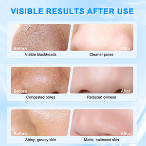 Mascarilla Limpiadora de Pasta de Frijol Negro con Roca Volcánica, Vitamina C, Control de Grasa Herbal, Limpieza Profunda de Poros, Lodo Facial de Caolín, Arcilla Volcánica - Product Image 5
