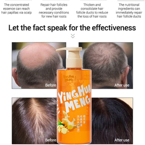 Shampoo au gingembre en marque privée pour la croissance des cheveux, anti-chute, lissage et nutrition du <span class=keywords><strong>cuir</strong></span> <span class=keywords><strong>chevelu</strong></span> avec des extraits naturels - Product Image 5
