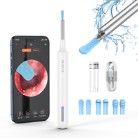 Prix de liquidation : Outil de nettoyage d'oreilles avec caméra Wi-Fi, Endoscope pour cérumen