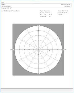 BIO-1000 WELLSIGHT CE ISO Perímetro Oftálmico Automatizado para Pruebas de <span class=keywords><strong>Campo</strong></span> <span class=keywords><strong>Visual</strong></span>, 1 Año de Garantía, 25 KG - Product Image 6