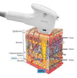 Equipo de Belleza Litian LT-LB11 de Material ABS para Lifting y Reafirmación No Invasiva para Contorno Corporal - Product Image 5