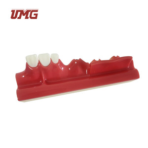 Modelo Dental Seccionado de Implantes, Material de Resina, Marca UMG con Certificación CE para Prácticas Estudiantiles - Product Image 4