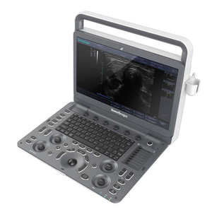 Escáner de Ultrasonido Veterinario <span class=keywords><strong>Sonoscape</strong></span> E1v <span class=keywords><strong>Vet</strong></span> 3D 2D Blanco y Negro Portátil Veterinario Ultrasonido BW - Product Image 1
